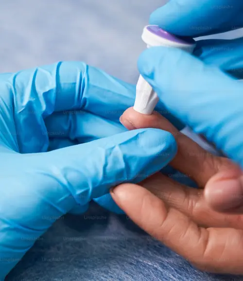 finger-prick test
